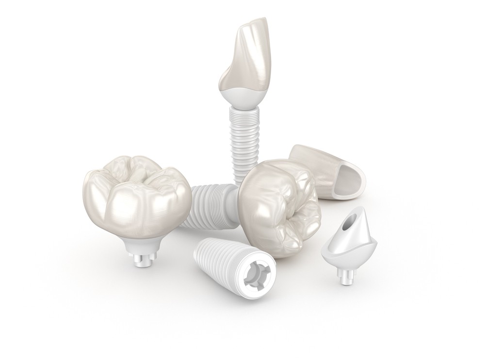 implant ceramic, implanturi dentare, implant straumann, implanturi straumann, implant straumann pret
